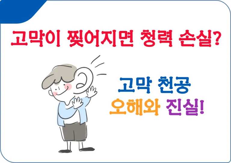 고막이 찢어지면 청력 손실? 고막 천공 오해와 진실을 알아봤어요. 고막은 우리 귀 내부에 있는 아주 중요한 막입니다. 이 막이 소리를 진동시키며, 우리가 세상의 소리를 듣는 데 핵심적인 역할을 하죠. 이번 글을 통해 고막 찢어짐의 증상, 원인, 그리고 대처 방법에 대해 자세히 알아보겠습니다.