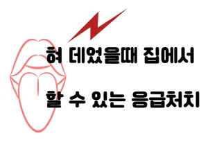혀 데었을때 나타나는 집에서 할 수 있는 응급처치와 증상들을 알아보아요~~ 미리미리 대비해서 큰 사고를 막아야해요~~