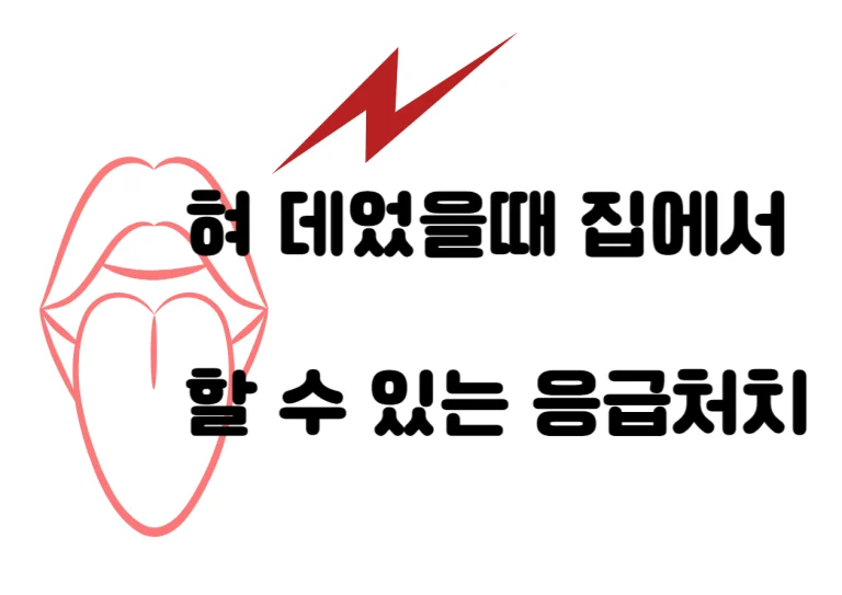 혀 데었을때 나타나는 집에서 할 수 있는 응급처치와 증상들을 알아보아요~~ 미리미리 대비해서 큰 사고를 막아야해요~~