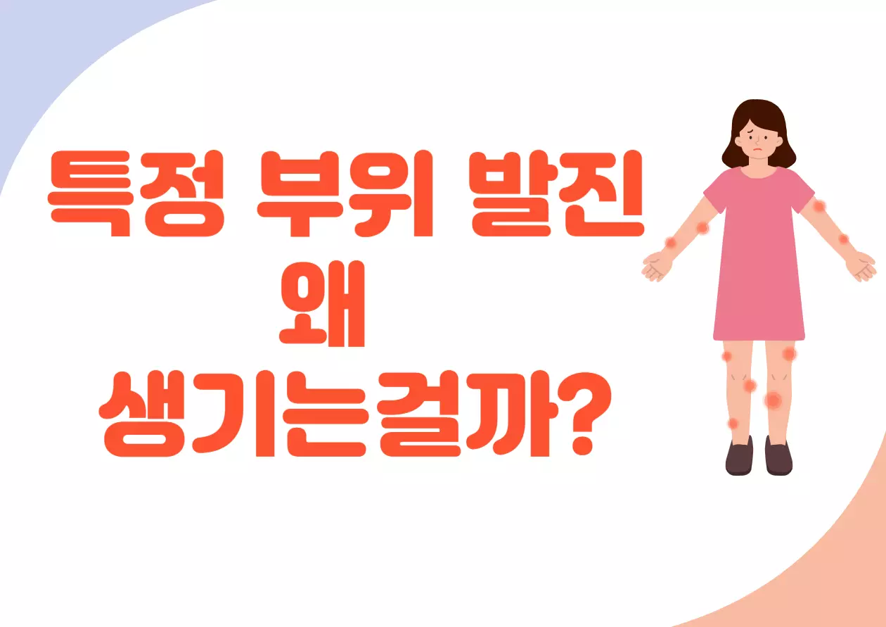 특정 부위 발진이 생기면 조금 당황스러울 수 있어요. 왜 그 부위에만 붉은 반점이나 가려움이 생기는 걸까요? 생각보다 간단한 이유와 함께, 쉽게 할 수 있는 예방법도 있답니다. 차근차근 알아보면서 어떻게 예방할 수 있는지 알아볼까요?