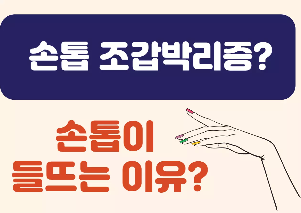 손톱 조갑박리증? 손톱 끝이 하얗게 변하고 들떠 보이나요? 이런 증상은 조갑박리증일 가능성이 있어요. 손톱은 우리 몸 상태를 보여주는 거울 같은 존재인데요, 손톱이 보내는 작은 SOS 신호, 지금부터 함께 알아볼까요?