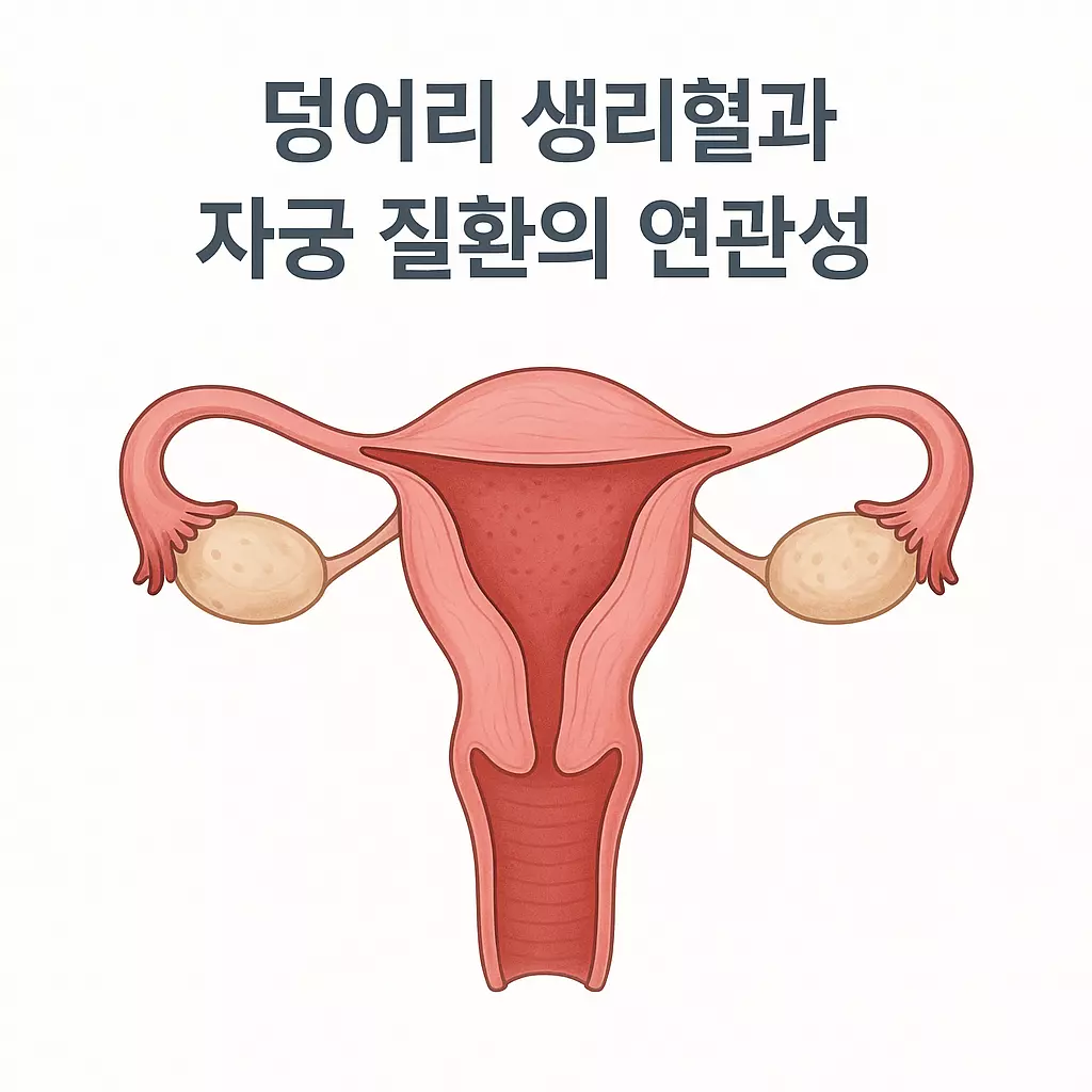 “여성 자궁 구조를 보여주는 일러스트로, 생리혈이 생성되고 덩어리로 배출되는 과정을 이해할 수 있게 구성된 해부도형 이미지”