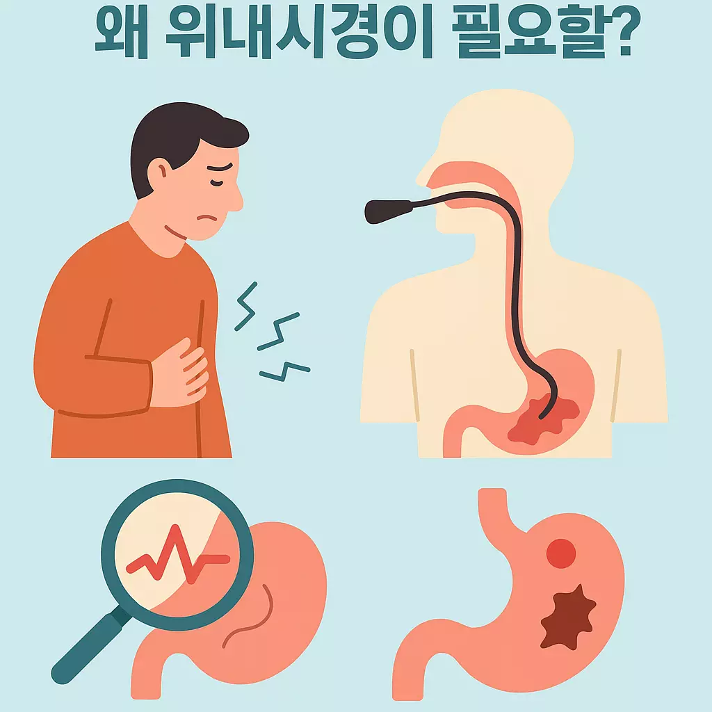 위내시경 검사의 필요성을 설명하는 일러스트